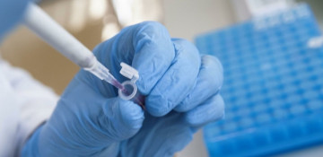 Azerbaijan confirms 1,690 more COVID-19 cases