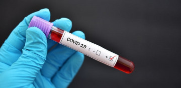 Azerbaijan reports 2,148 more COVID-19 cases