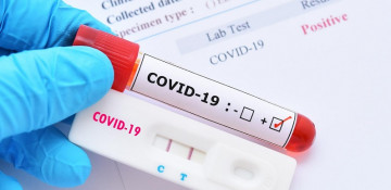Azerbaijan discloses latest data on new COVID-19 cases