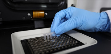 Turkish scientists design AI for COVID-19 detection