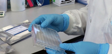 'Game-changing' antibody test can detect COVID-19 variants