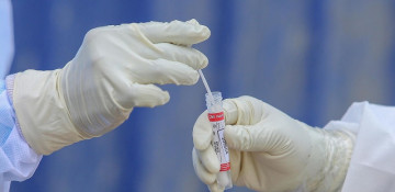 Delta strain revealed among 31 people who arrived in Azerbaijan