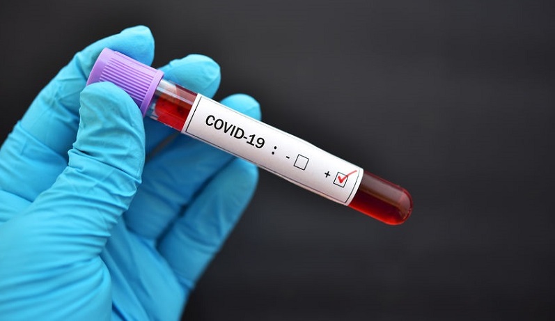 Azerbaijan reports 212 new coronavirus cases