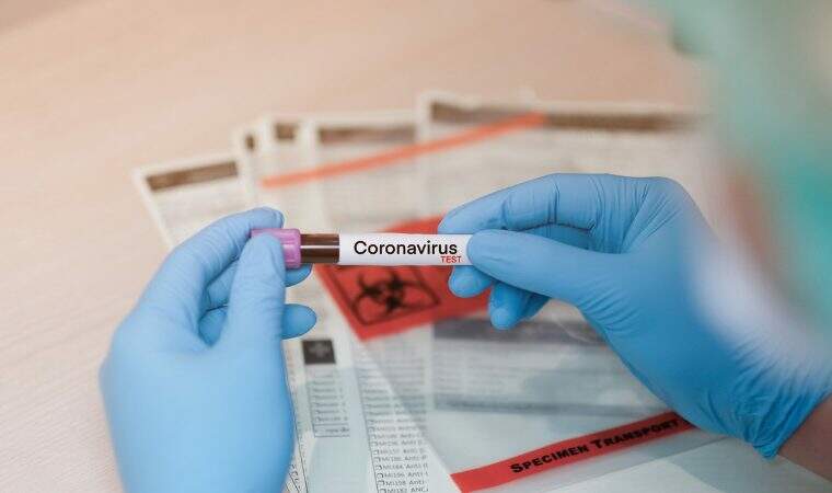 Azerbaijan's daily COVID-19 cases exceed 4,000