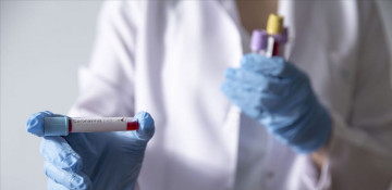 Azerbaijan logs 2,189 new COVID-19 cases