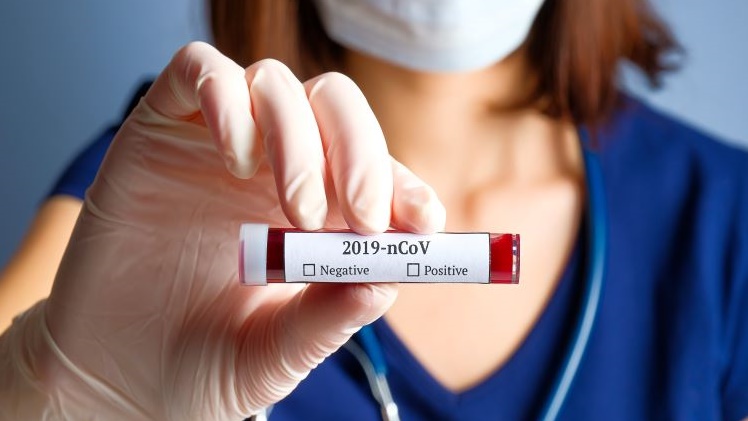 Azerbaijan adds 2,500 new COVID-19 cases