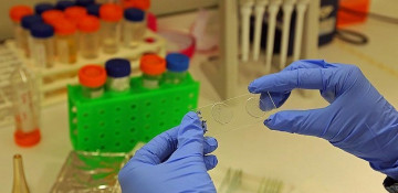 Researcher in Cameroon develops plant-based leukemia treatment