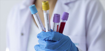 Azerbaijan records 273 new coronavirus cases