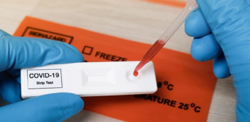 Azerbaijan logs 757 new COVID-19 cases