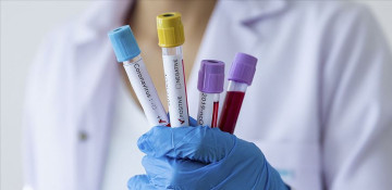 Azerbaijan adds 6,603 new COVID-19 cases