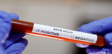 Azerbaijan logs 1 fresh coronavirus case over past day