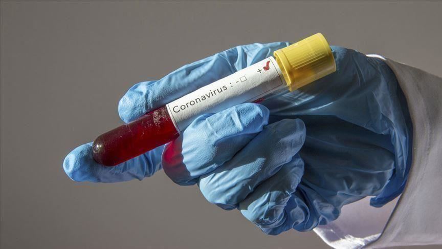 Azerbaijan reports 17 daily coronavirus cases