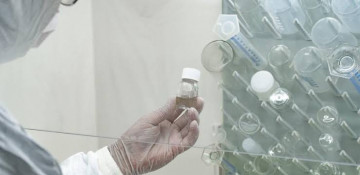 No monkeypox cases recorded in Azerbaijan: Health Ministry