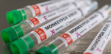 US confirms two cases of monkeypox infection in children