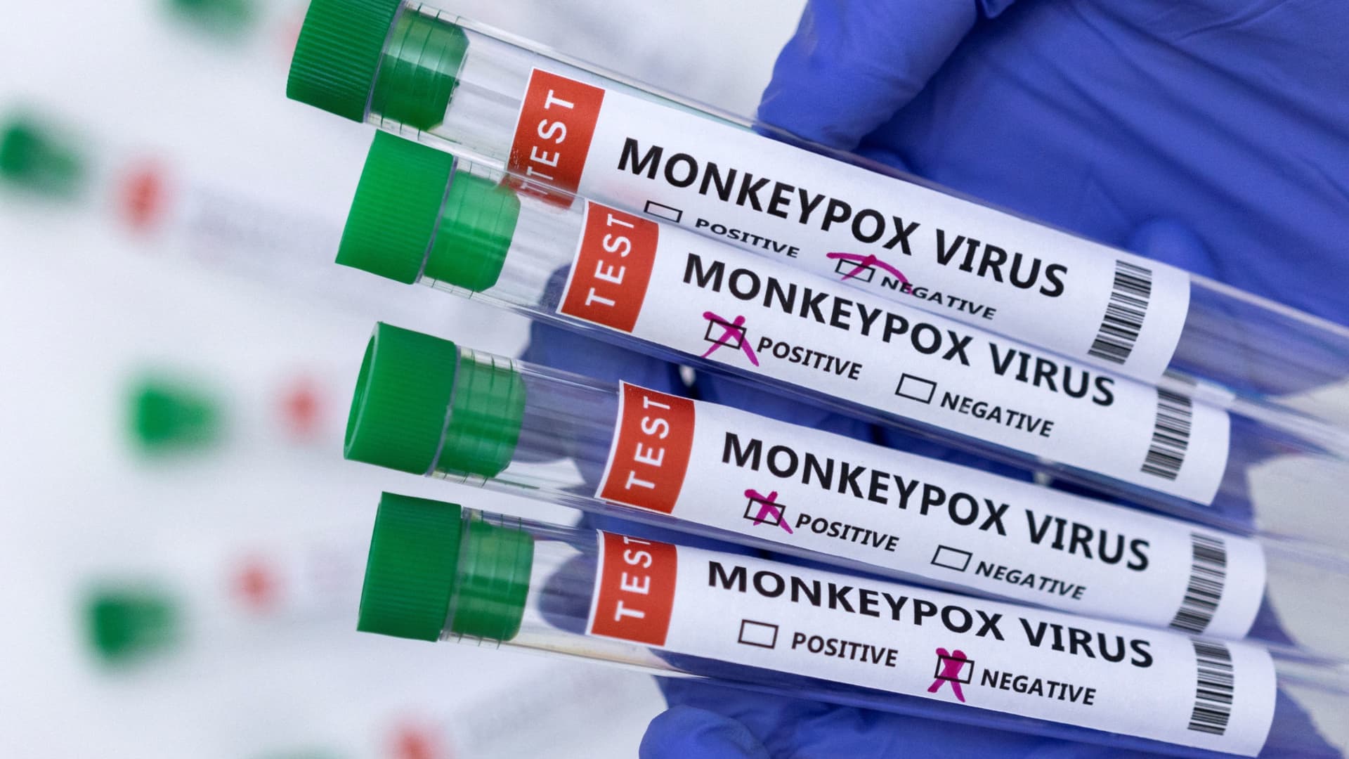 US confirmed monkeypox cases rise to 3,600
