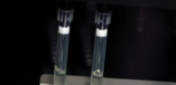 Spain reports second monkeypox-related death in Europe