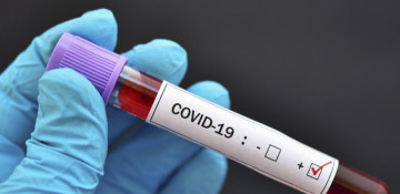 Azerbaijan logs 534 fresh coronavirus cases, 6 deaths over the past day