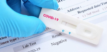 Azerbaijan logs 488 fresh coronavirus cases, no death over past day