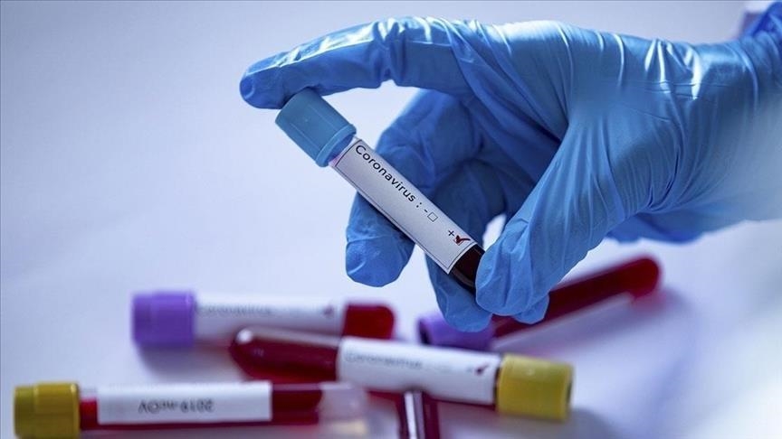 Azerbaijan records nearly 500 new coronavirus cases