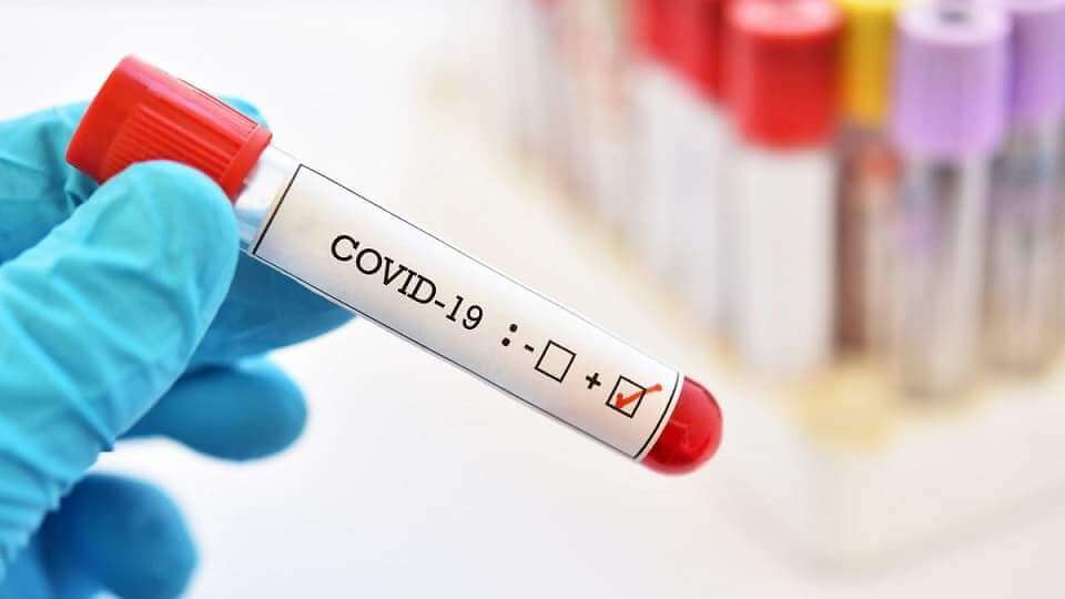 Azerbaijan reports nearly 150 coronavirus cases in a day