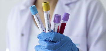 Azerbaijan reports 568 daily coronavirus cases