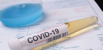 Azerbaijan logs 396 fresh coronavirus cases, 5 deaths over past day