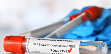 Azerbaijan logs 214 fresh coronavirus cases, no death over past day