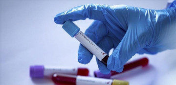 Azerbaijan records nearly 100 coronavirus cases in a day