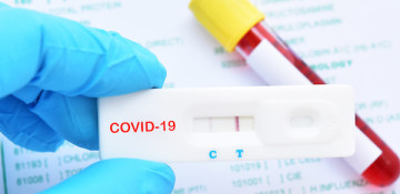 Azerbaijan logs 56 fresh coronavirus cases, 2 deaths over past day