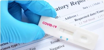 Azerbaijan confirms 41 more COVID-19 cases, 63 recoveries