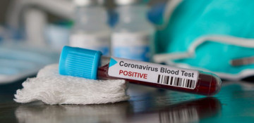 Azerbaijan logs 38 fresh coronavirus cases