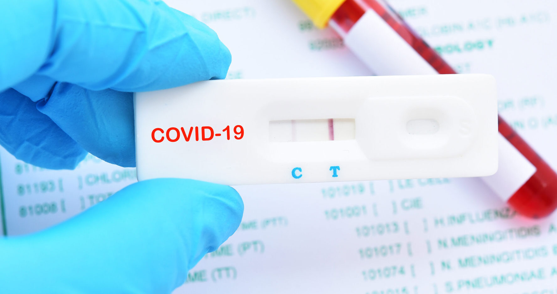 Azerbaijan confirms 44 more COVID-19 cases, 9 recoveries
