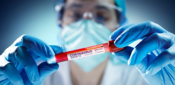 Azerbaijan registers 67 daily coronavirus cases