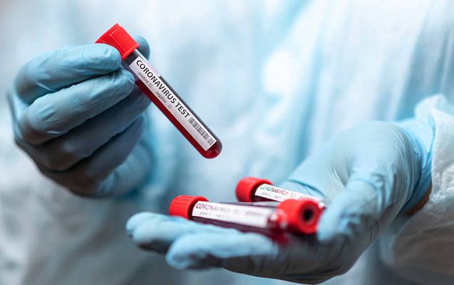 Azerbaijan reports 115 daily coronavirus cases