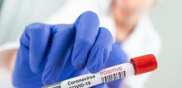 Azerbaijan logs 106 fresh coronavirus cases, 4 deaths over past day