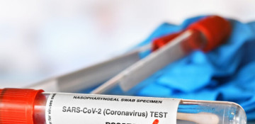 Azerbaijan logs 34 fresh coronavirus cases, no death over past day