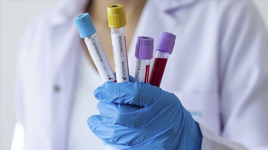 Azerbaijan registers two daily coronavirus cases