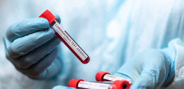 Azerbaijan documents 21 daily coronavirus cases