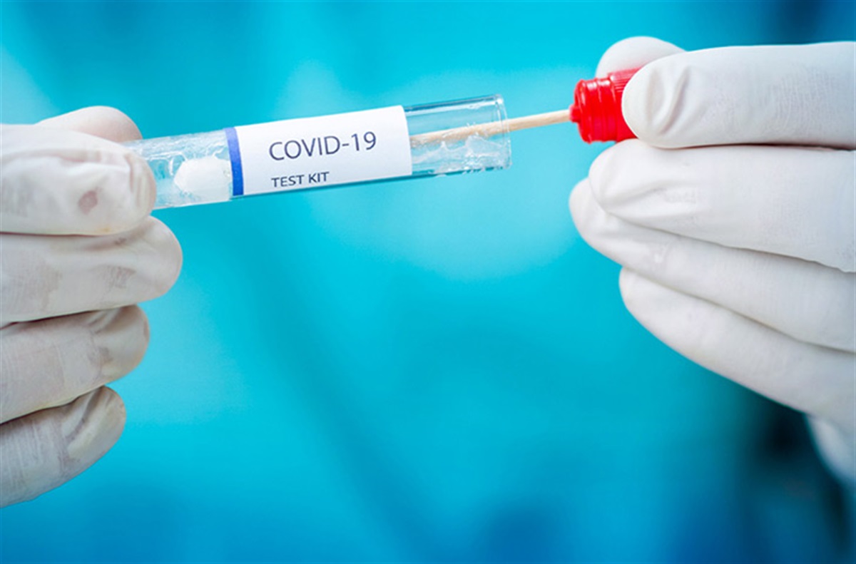 Azerbaijan logs 10 new COVID-19 cases