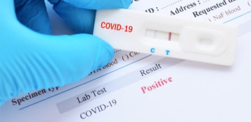 Azerbaijan logged 15 new COVID-19 cases over past week
