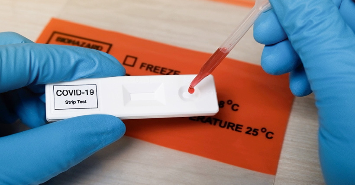 Azerbaijan reports 19 new COVID-19 cases over past week