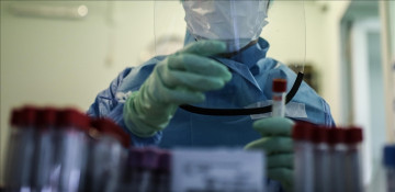 Lassa fever kills 10 in Nigeria