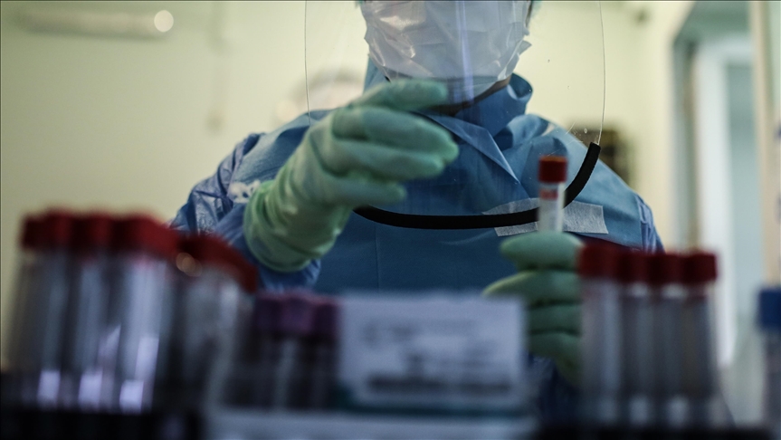 Lassa fever kills 10 in Nigeria